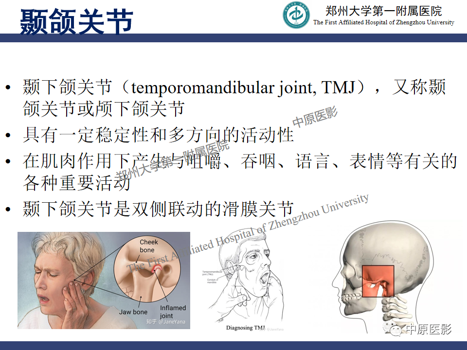 影像PPT - 【PPT】颞颌关节紊乱病的MRI诊断-3