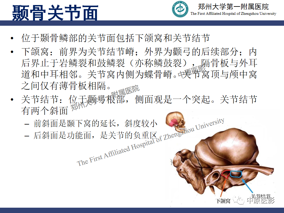 影像PPT - 【PPT】颞颌关节紊乱病的MRI诊断-6