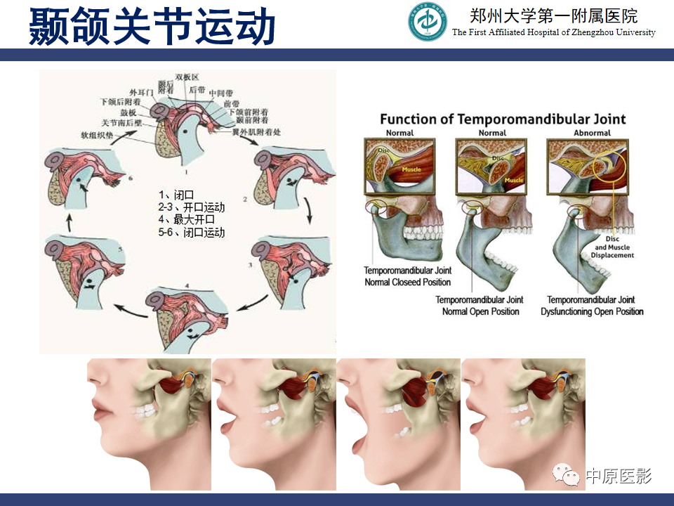 影像PPT - 【PPT】颞颌关节紊乱病的MRI诊断-16