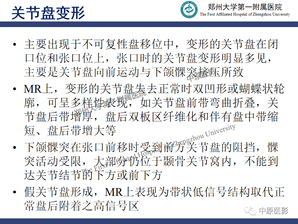 影像PPT - 【PPT】颞颌关节紊乱病的MRI诊断-67