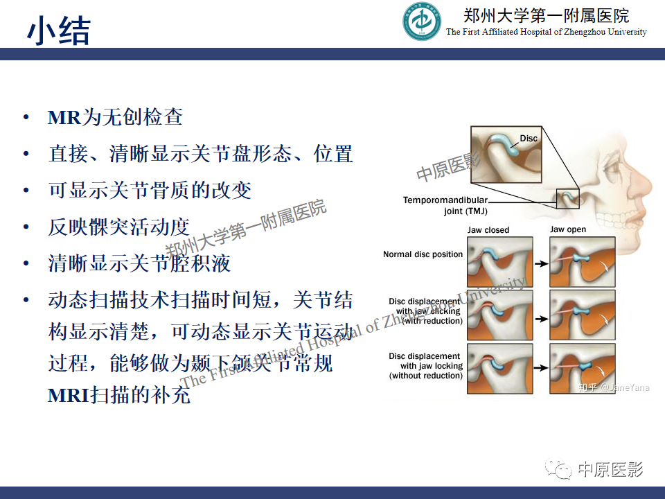 影像PPT - 【PPT】颞颌关节紊乱病的MRI诊断-80