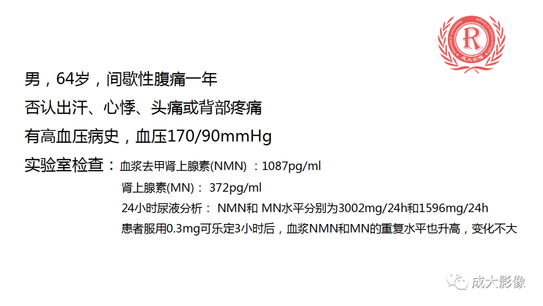 影像PPT - 【PPT】肾上腺嗜铬细胞瘤的CT及MRI表现-1