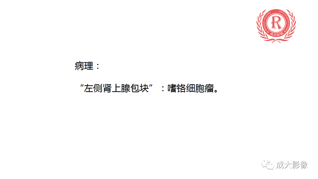 影像PPT - 【PPT】肾上腺嗜铬细胞瘤的CT及MRI表现-3