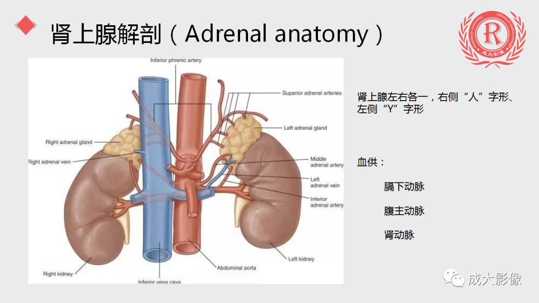 影像PPT - 【PPT】肾上腺嗜铬细胞瘤的CT及MRI表现-6