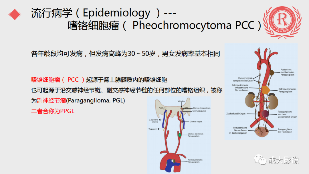 影像PPT - 【PPT】肾上腺嗜铬细胞瘤的CT及MRI表现-8