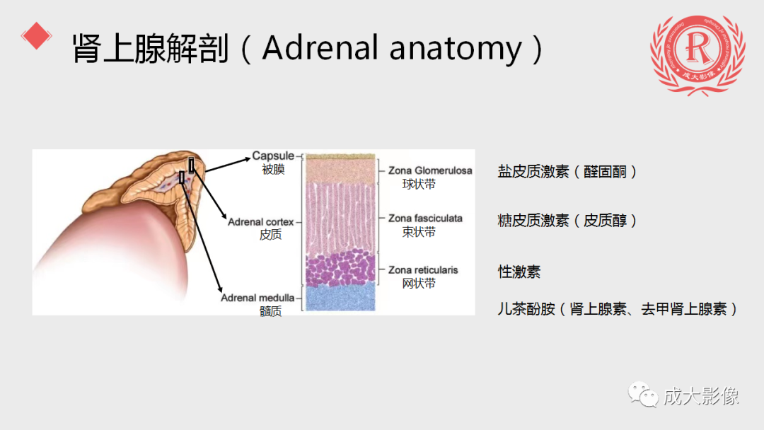 影像PPT - 【PPT】肾上腺嗜铬细胞瘤的CT及MRI表现-7
