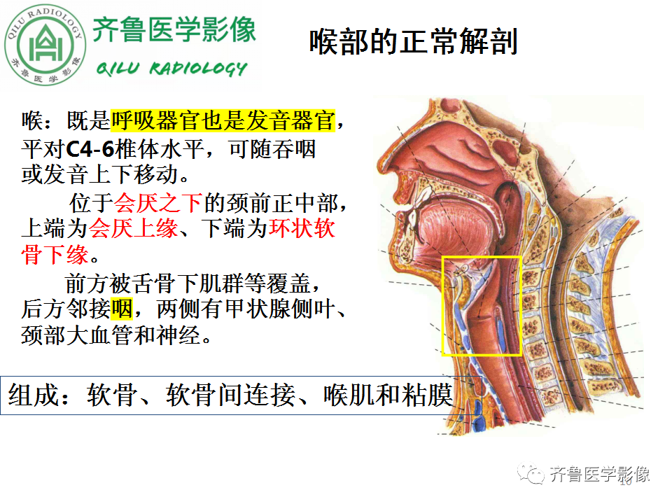 影像PPT - 【PPT】喉癌的定位、诊断及鉴别诊断-10