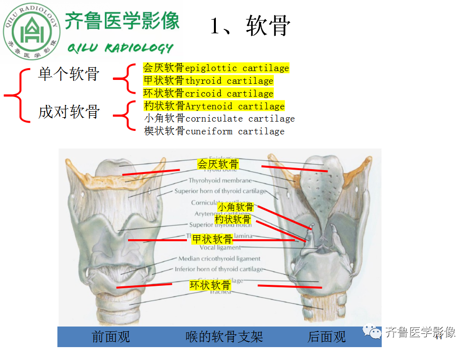 影像PPT - 【PPT】喉癌的定位、诊断及鉴别诊断-11