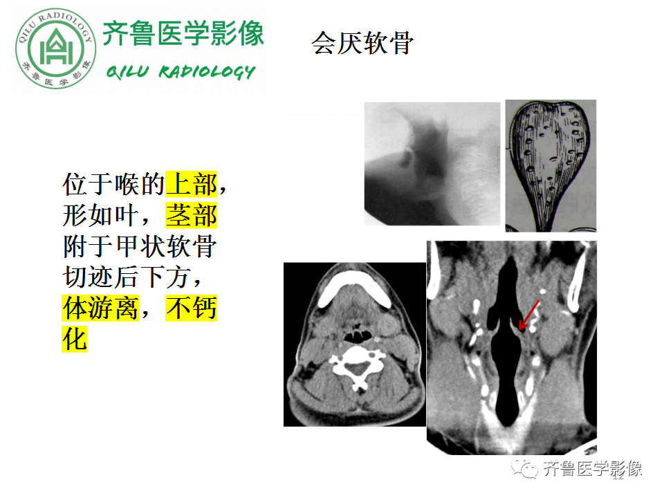 影像PPT - 【PPT】喉癌的定位、诊断及鉴别诊断-12