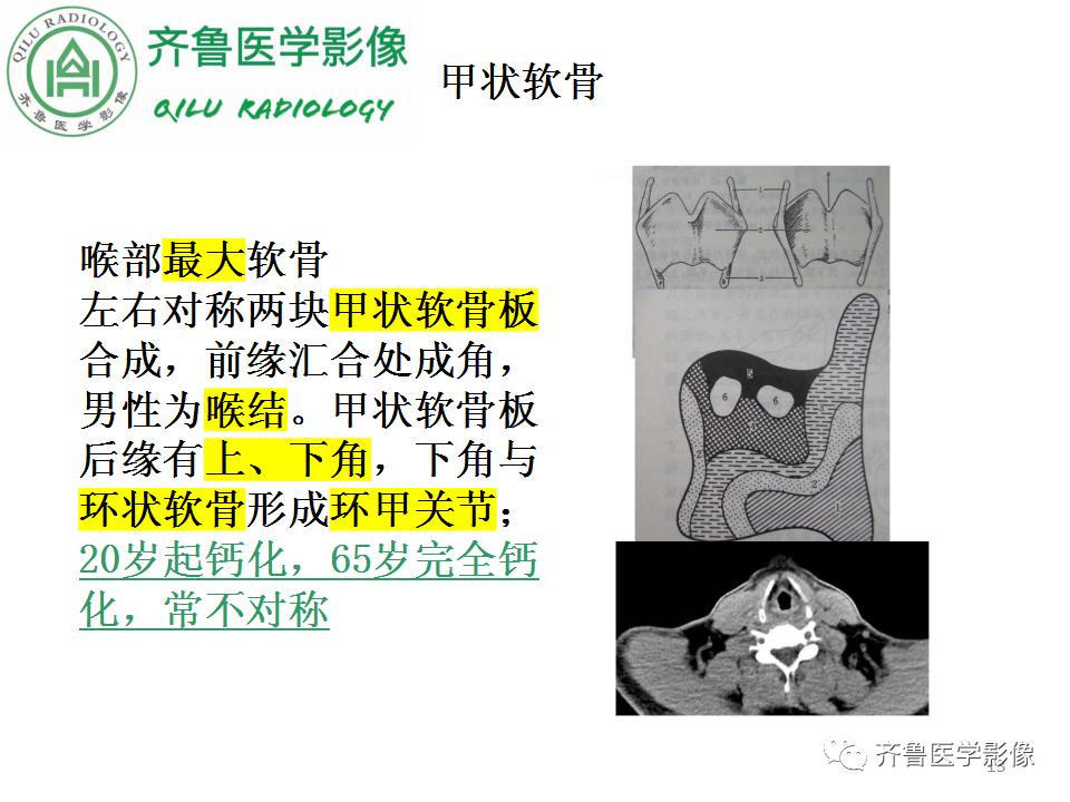 影像PPT - 【PPT】喉癌的定位、诊断及鉴别诊断-13