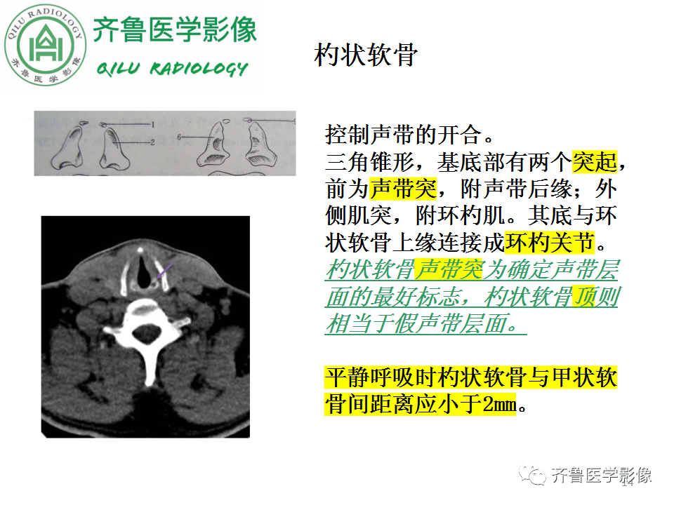 影像PPT - 【PPT】喉癌的定位、诊断及鉴别诊断-14