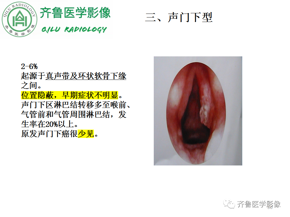 影像PPT - 【PPT】喉癌的定位、诊断及鉴别诊断-29