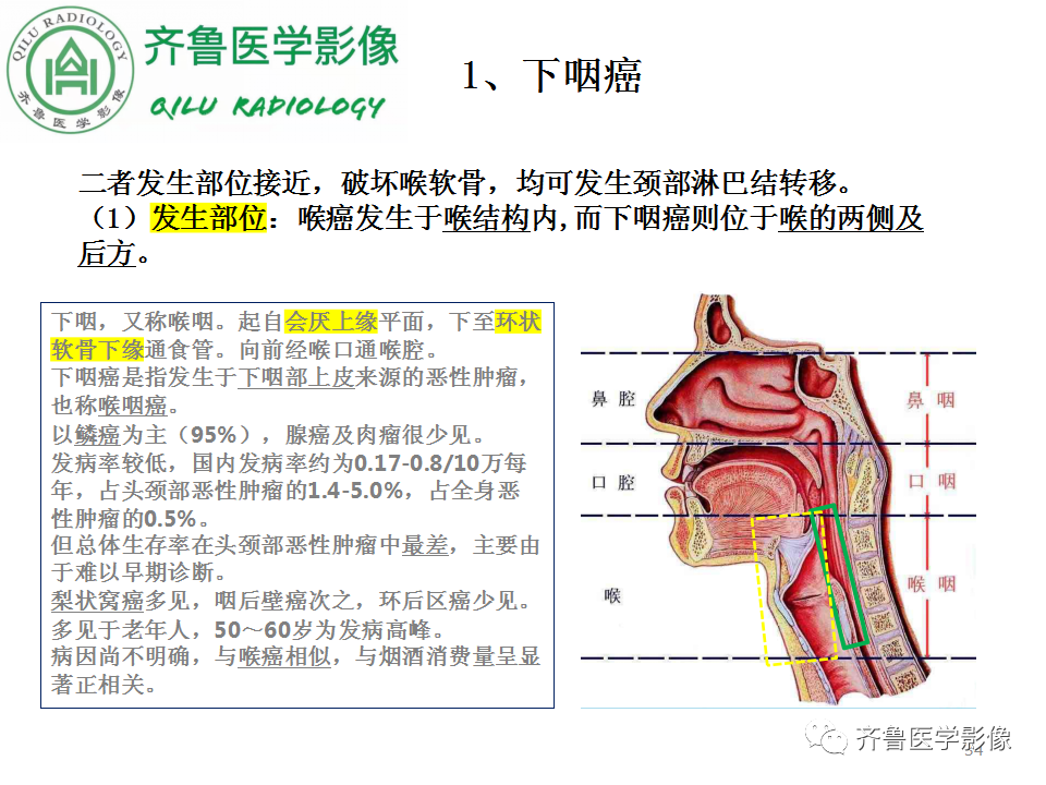 影像PPT - 【PPT】喉癌的定位、诊断及鉴别诊断-32