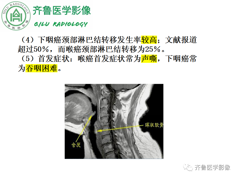 影像PPT - 【PPT】喉癌的定位、诊断及鉴别诊断-35