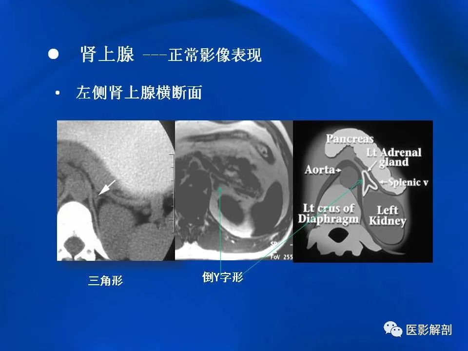 影像PPT - 【PPT】肾上腺解剖及相关病变的影像诊断-12