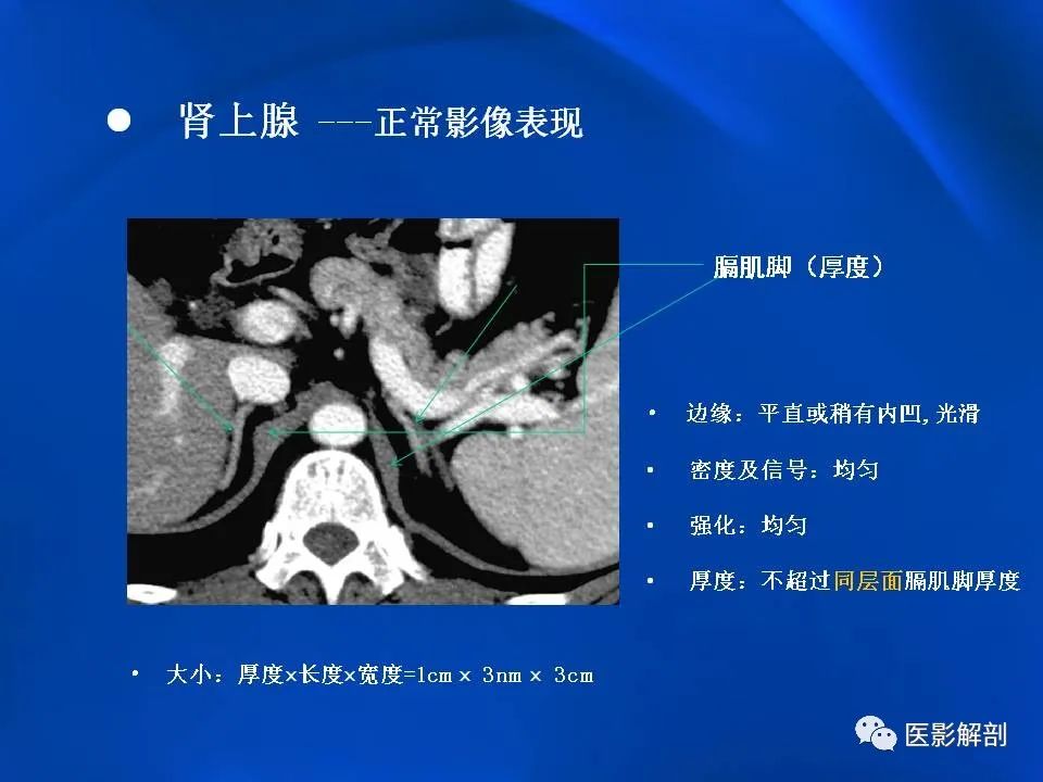 影像PPT - 【PPT】肾上腺解剖及相关病变的影像诊断-14