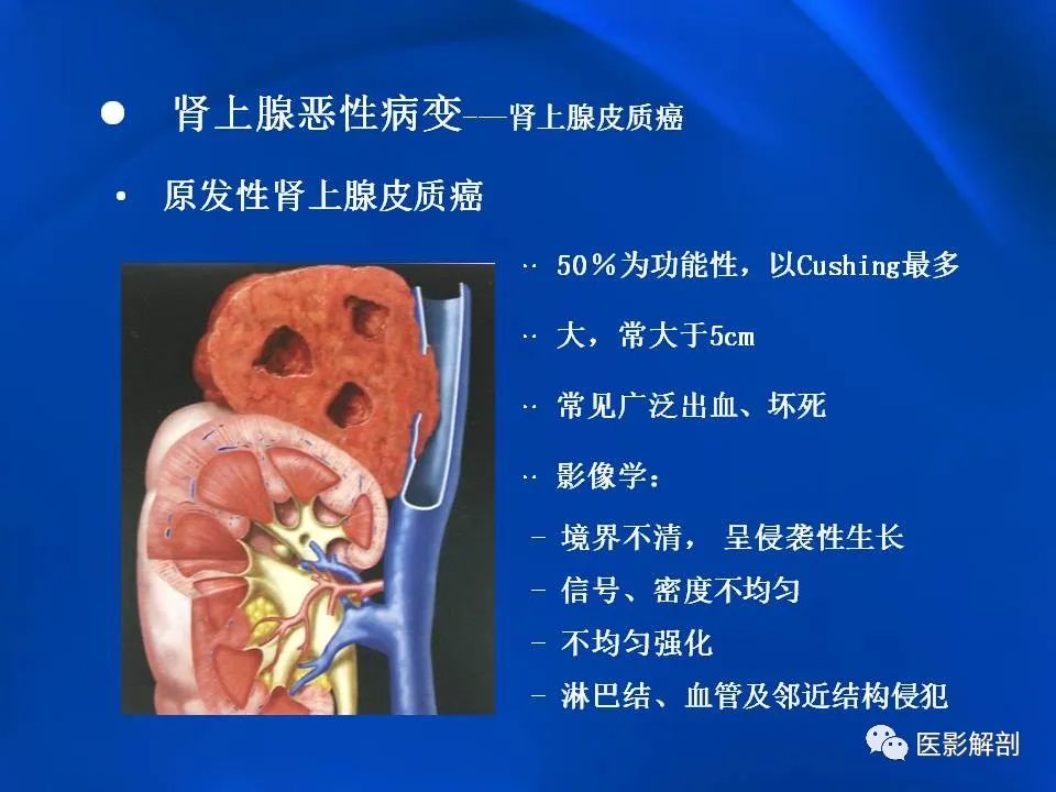 影像PPT - 【PPT】肾上腺解剖及相关病变的影像诊断-86