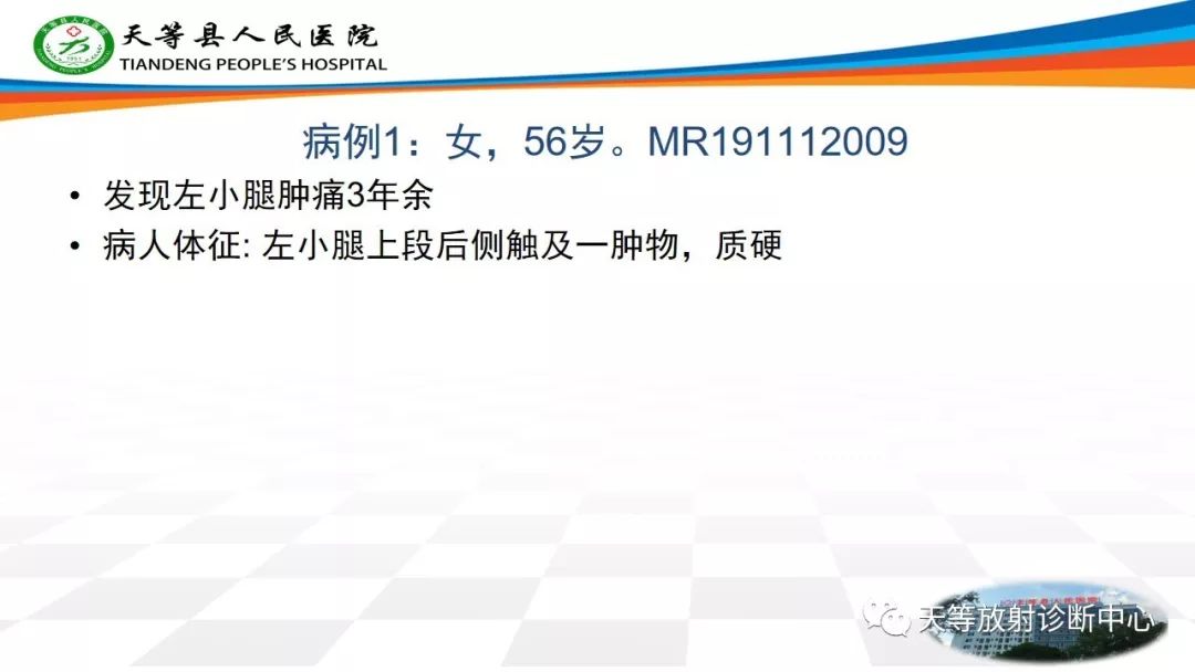 影像PPT - 【PPT】软组织神经鞘瘤影像学诊断-1