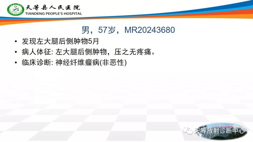 影像PPT - 【PPT】软组织神经鞘瘤影像学诊断-11