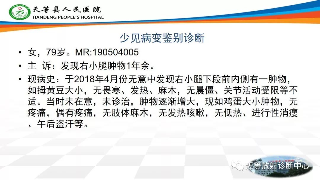影像PPT - 【PPT】软组织神经鞘瘤影像学诊断-32
