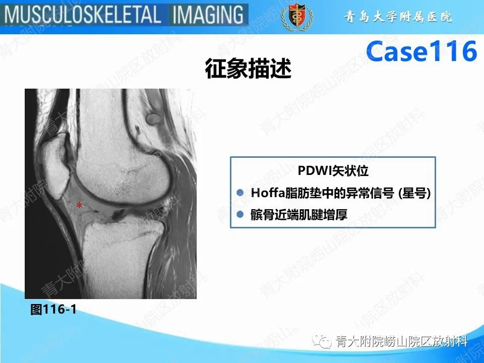 影像PPT - 【PPT】Hoffa病-22