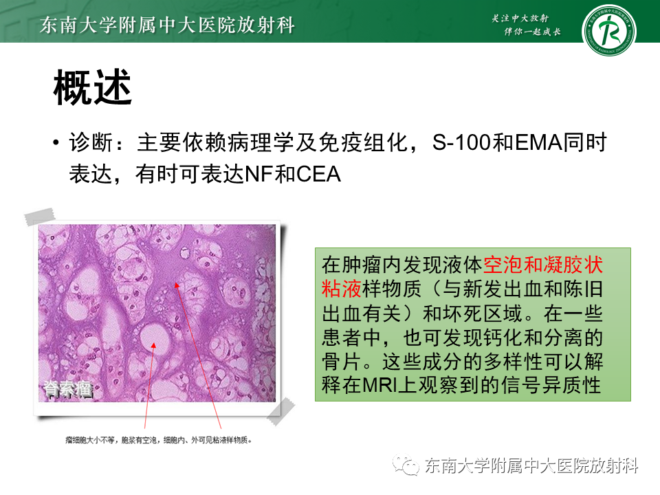 影像PPT - 【PPT】骶骨常见肿瘤-11 影像PPT - 【PPT】骶骨常见肿瘤-11