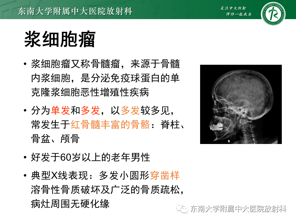 影像PPT - 【PPT】骶骨常见肿瘤-27 影像PPT - 【PPT】骶骨常见肿瘤-27