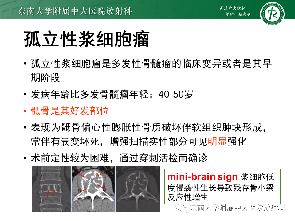 影像PPT - 【PPT】骶骨常见肿瘤-28 影像PPT - 【PPT】骶骨常见肿瘤-28