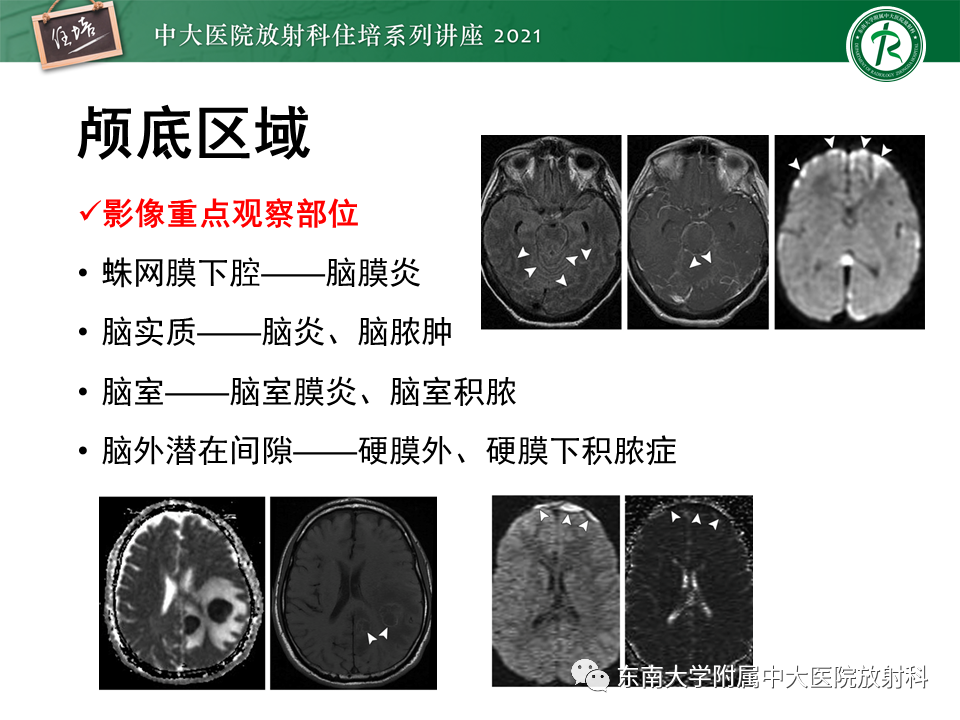 影像PPT - 【PPT】大脑皮层常见弥漫性病变的诊断思路-7