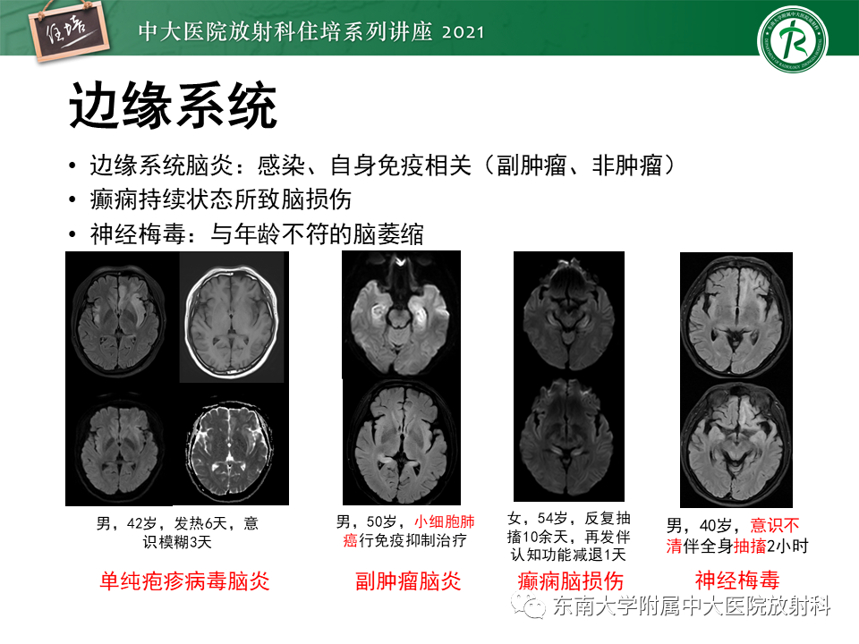 影像PPT - 【PPT】大脑皮层常见弥漫性病变的诊断思路-11