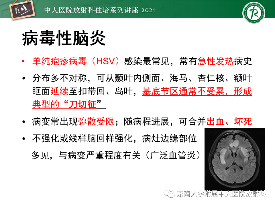 影像PPT - 【PPT】大脑皮层常见弥漫性病变的诊断思路-12