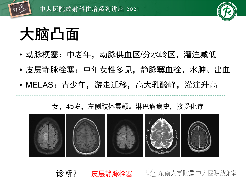影像PPT - 【PPT】大脑皮层常见弥漫性病变的诊断思路-19