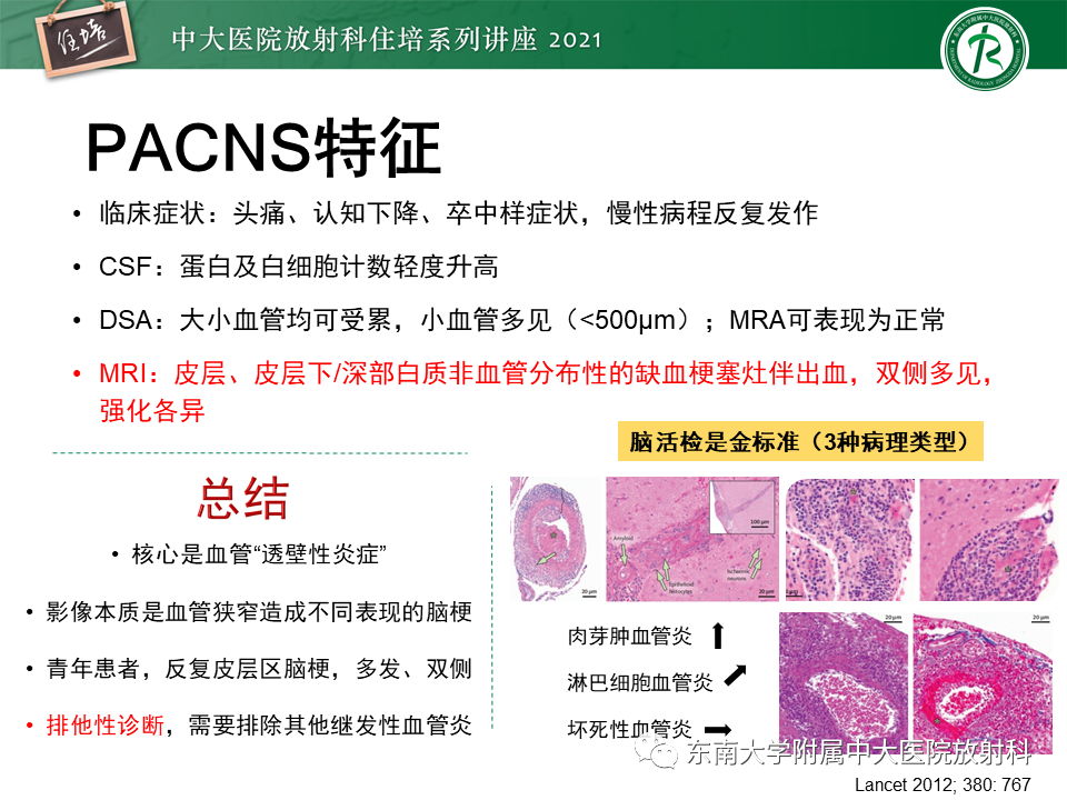 影像PPT - 【PPT】大脑皮层常见弥漫性病变的诊断思路-23