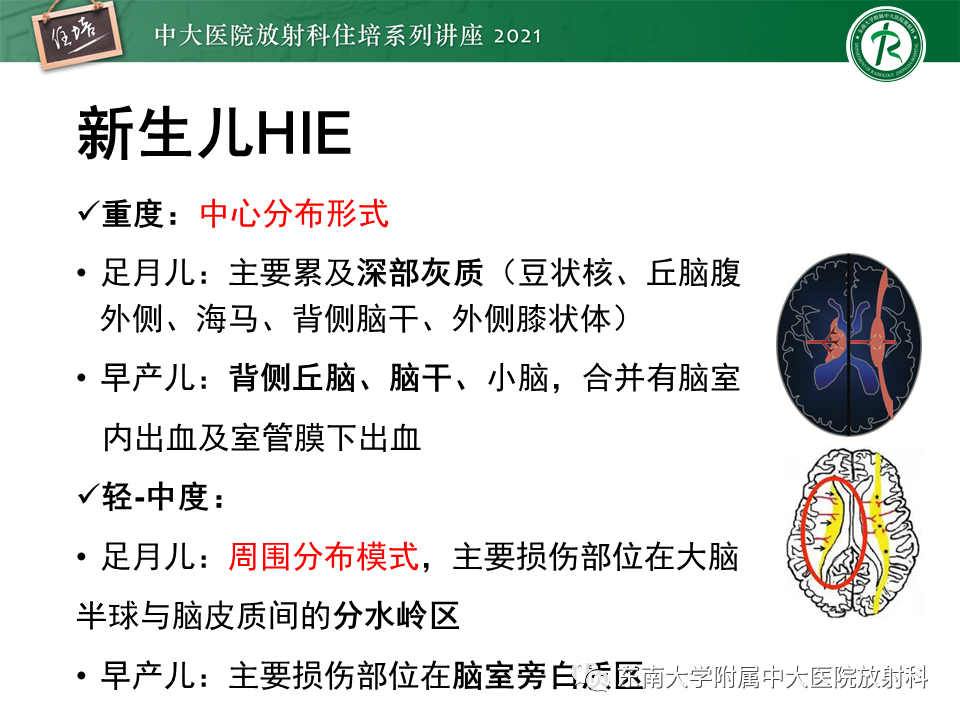 影像PPT - 【PPT】大脑皮层常见弥漫性病变的诊断思路-28