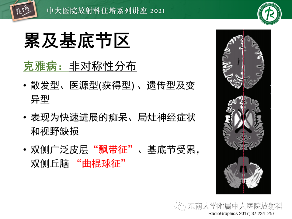 影像PPT - 【PPT】大脑皮层常见弥漫性病变的诊断思路-36