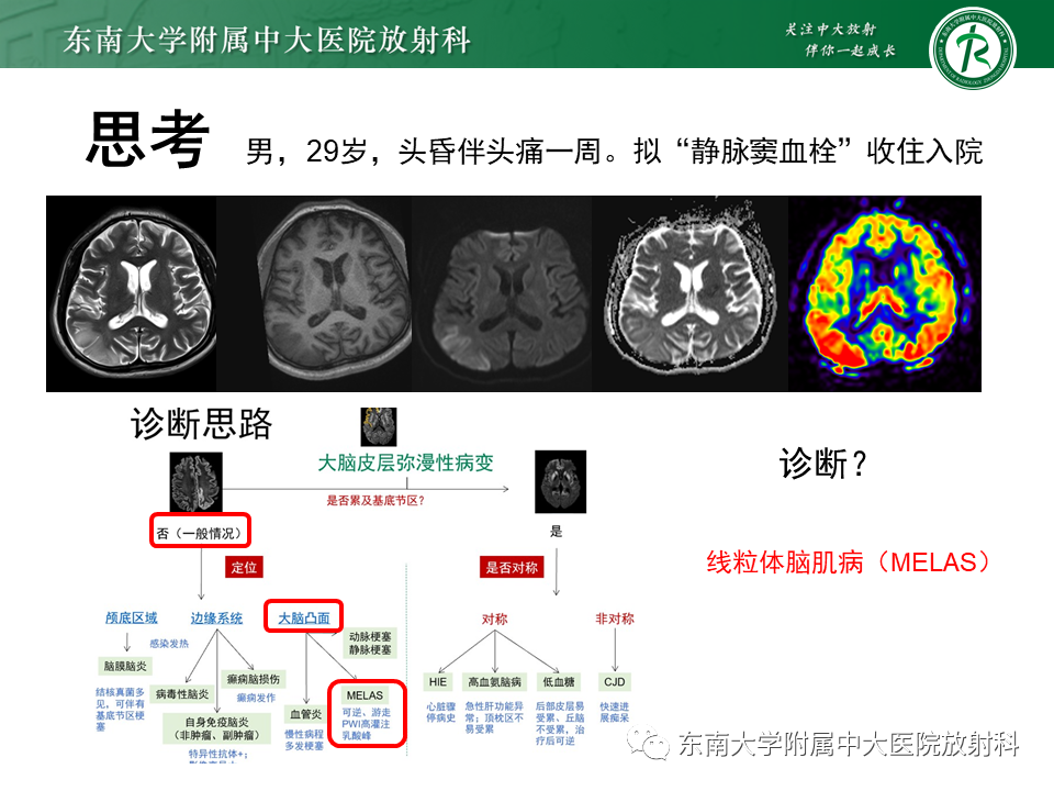 影像PPT - 【PPT】大脑皮层常见弥漫性病变的诊断思路-37