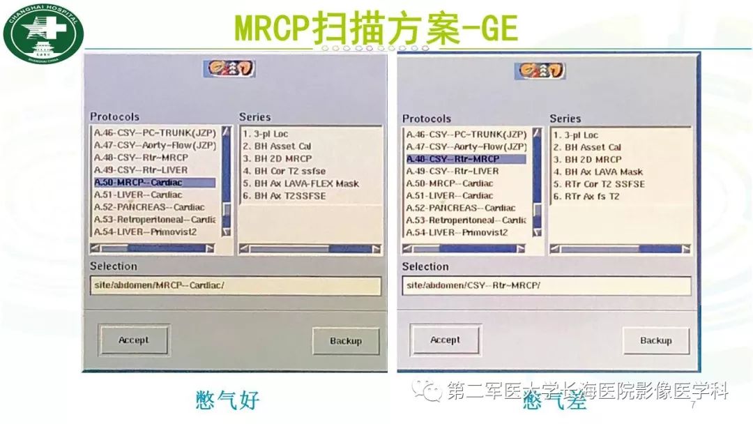 影像PPT - 【PPT】胰胆管水成像磁共振扫描规范-7