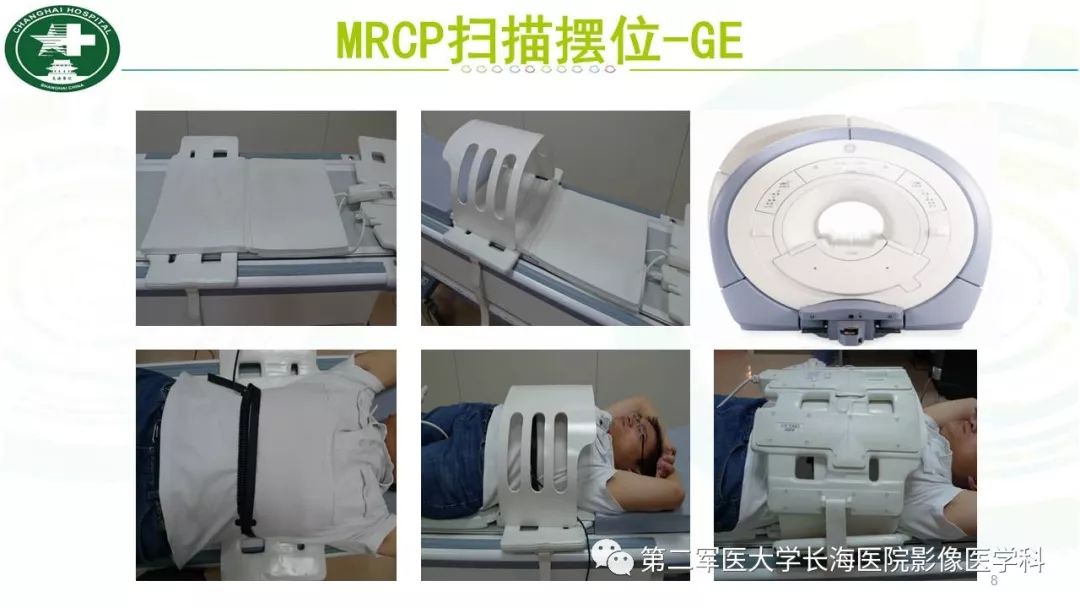 影像PPT - 【PPT】胰胆管水成像磁共振扫描规范-8