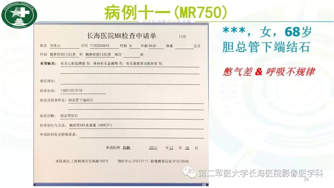 影像PPT - 【PPT】胰胆管水成像磁共振扫描规范-29