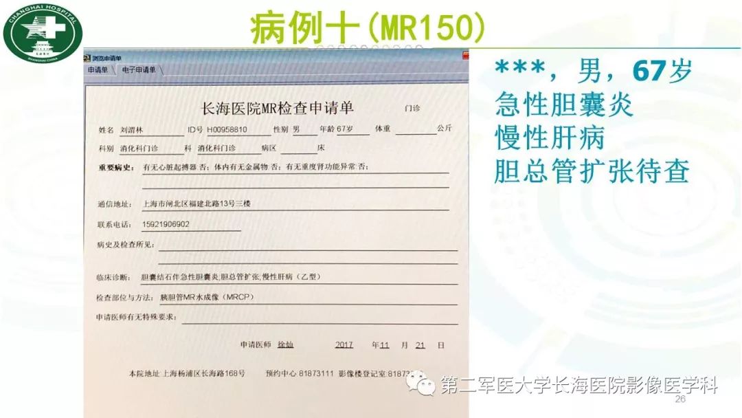 影像PPT - 【PPT】胰胆管水成像磁共振扫描规范-26