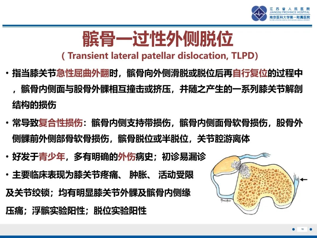 影像PPT - 【PPT】髌骨一过性外侧脱位-19