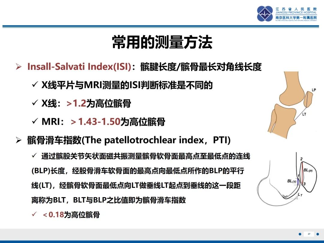 影像PPT - 【PPT】髌骨一过性外侧脱位-28
