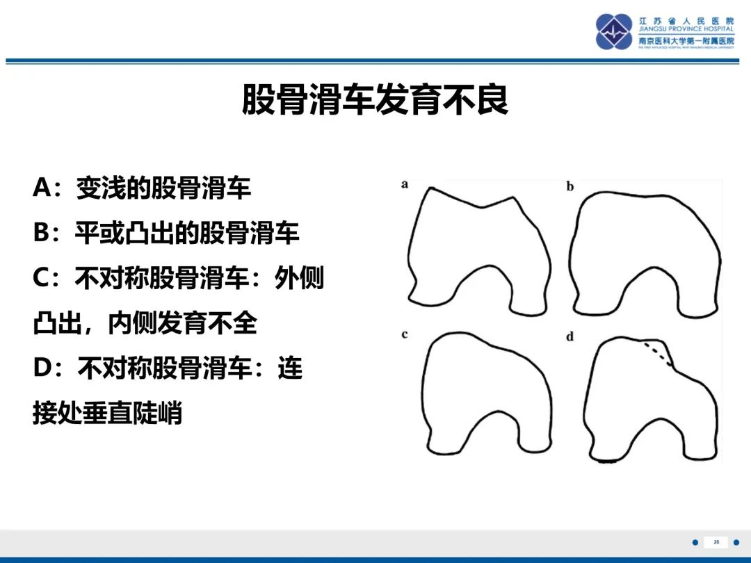 影像PPT - 【PPT】髌骨一过性外侧脱位-29