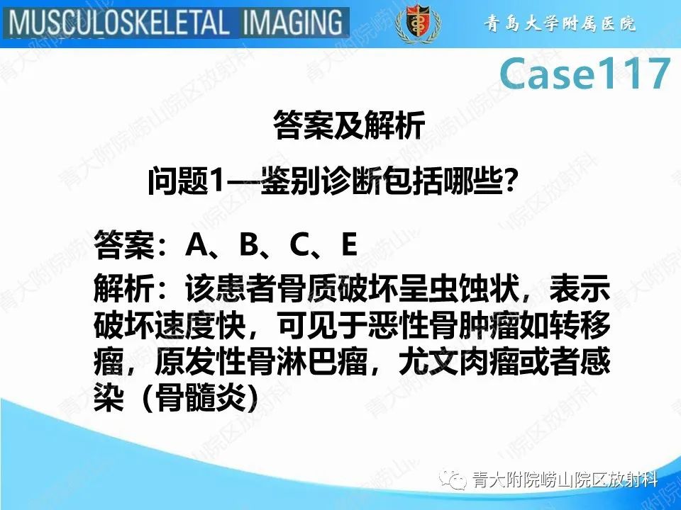 影像PPT - 【PPT】原发性骨淋巴瘤-4