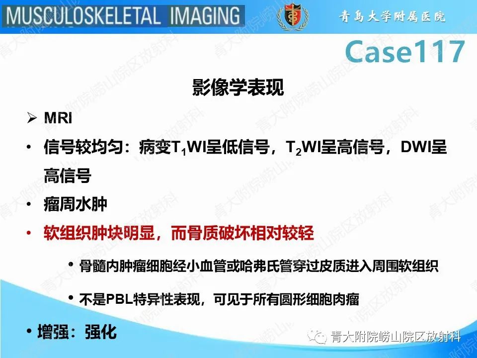 影像PPT - 【PPT】原发性骨淋巴瘤-7