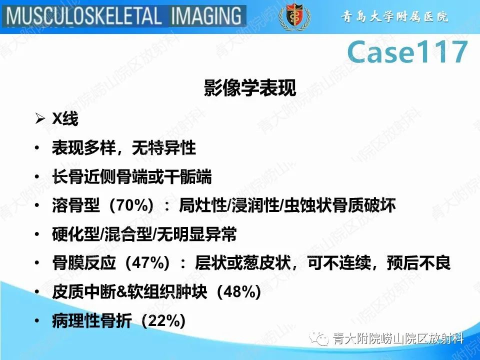 影像PPT - 【PPT】原发性骨淋巴瘤-6