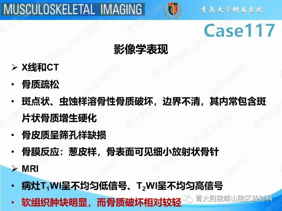 影像PPT - 【PPT】原发性骨淋巴瘤-13