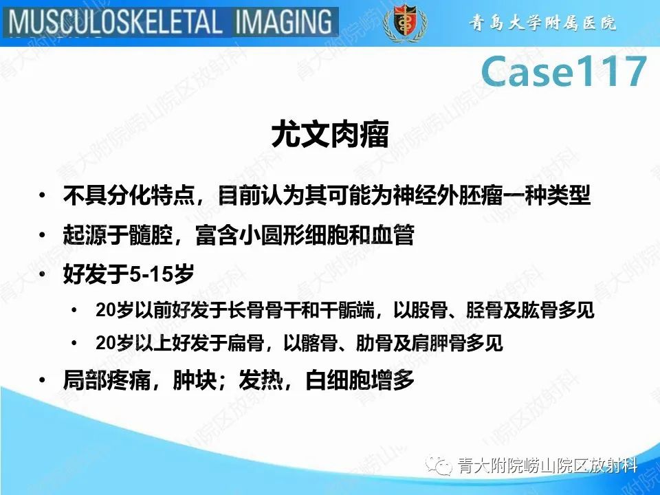 影像PPT - 【PPT】原发性骨淋巴瘤-12