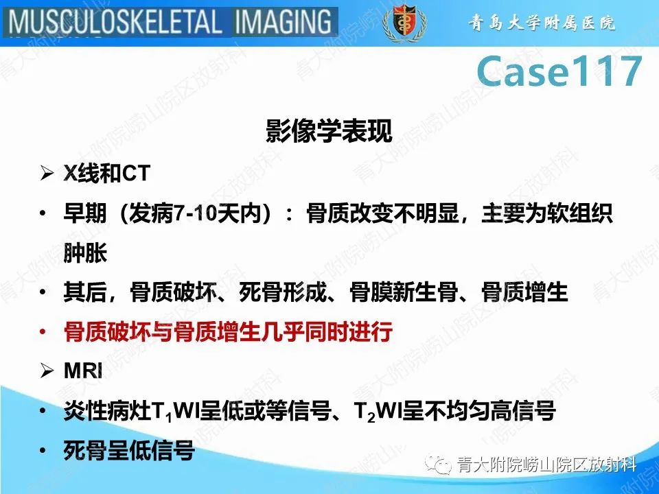 影像PPT - 【PPT】原发性骨淋巴瘤-17