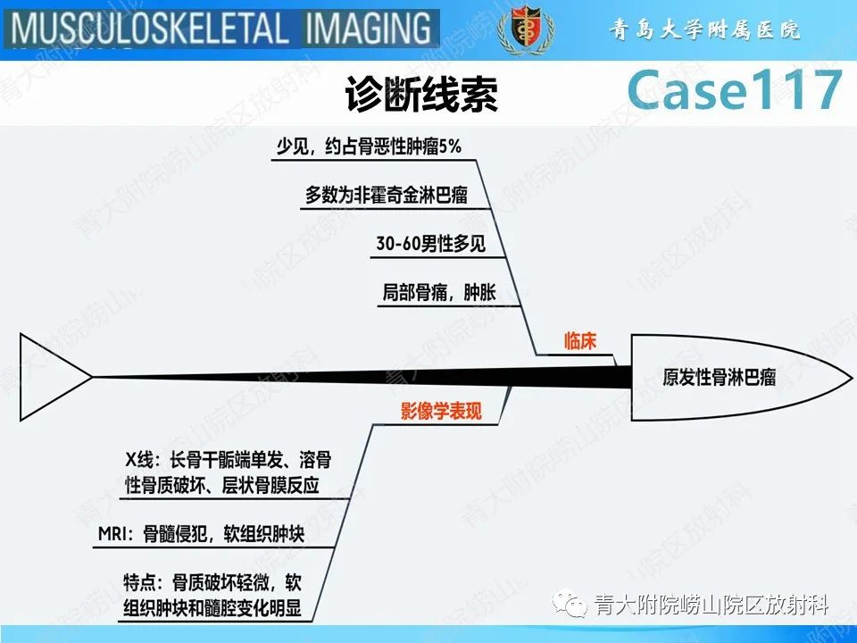 影像PPT - 【PPT】原发性骨淋巴瘤-28